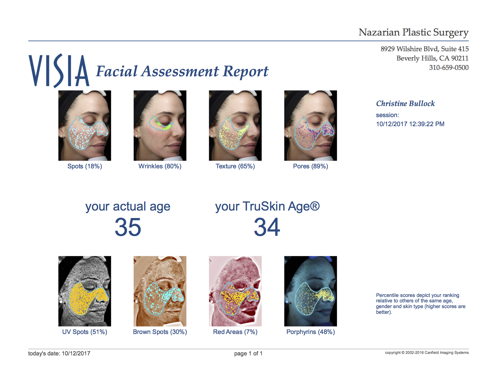 Visia Facial Assessment After