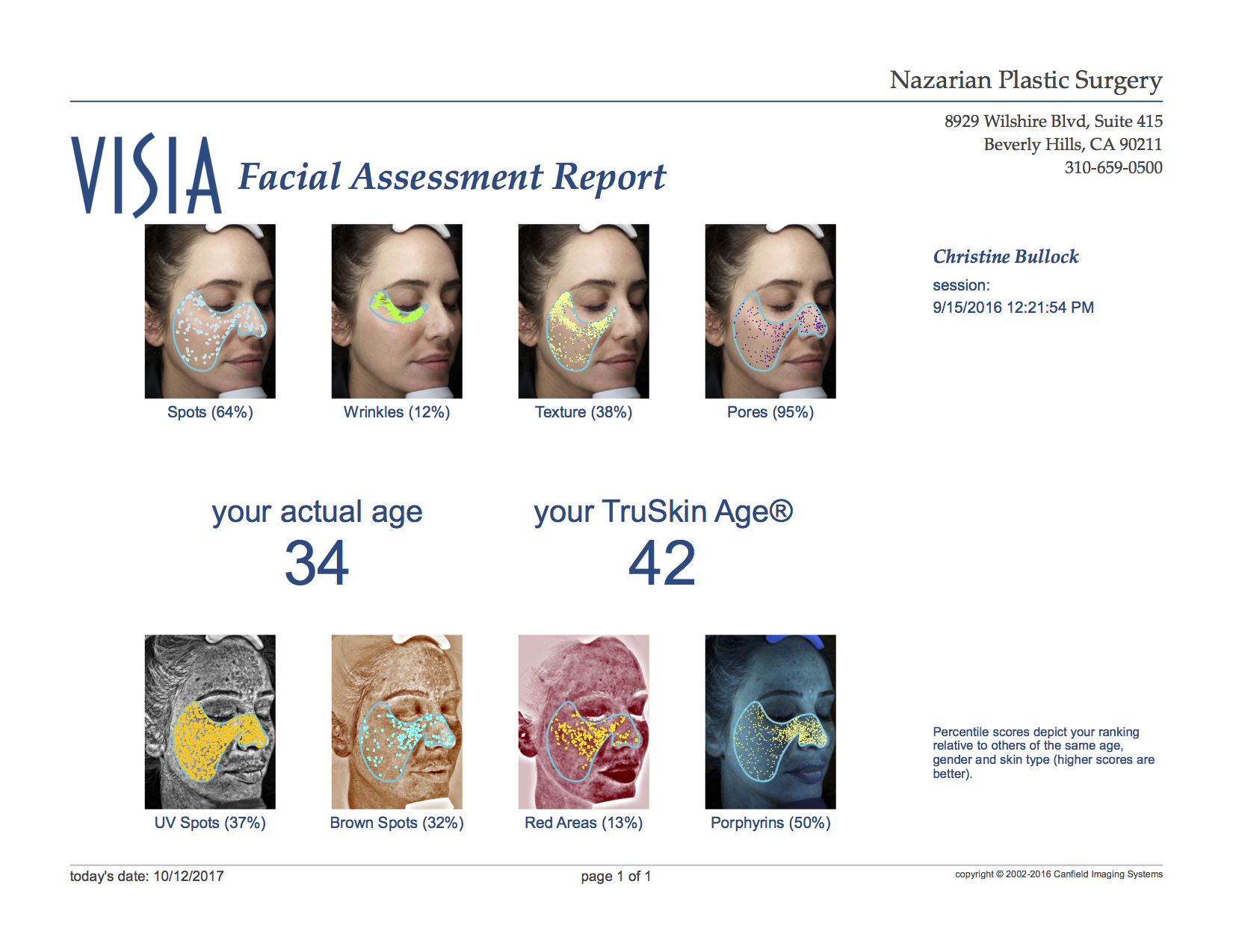 Visia Facial Assessment Before